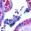 Crystal violet solution
