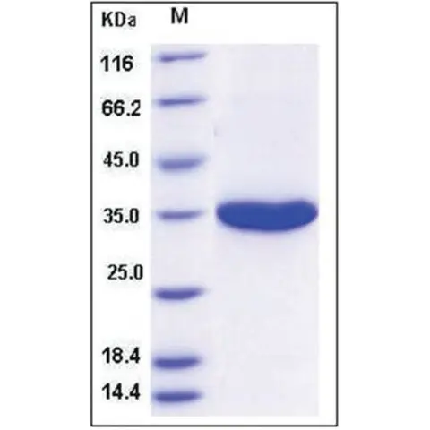 Kallikrein-3 human